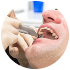CEREC