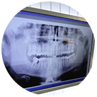 digital x-ray