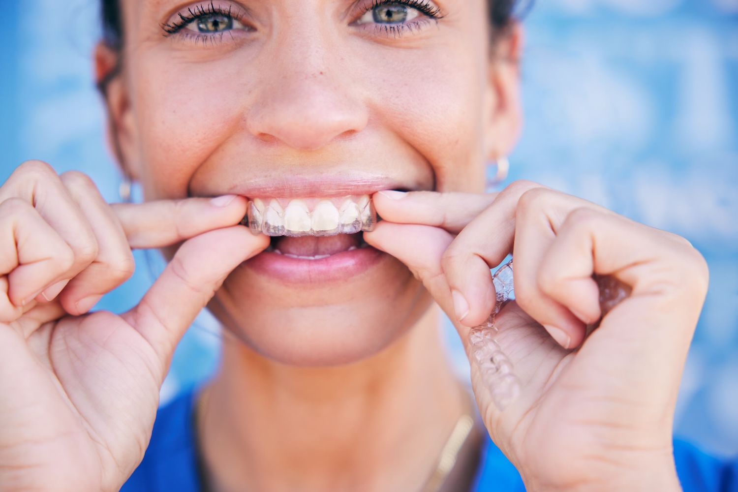 straighten teeth with invisalign, do straight teeth improve oral health