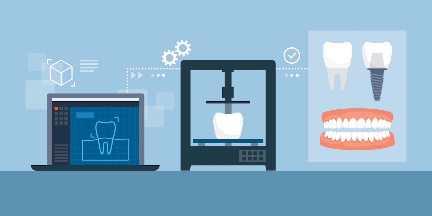 3d printing in dentistry