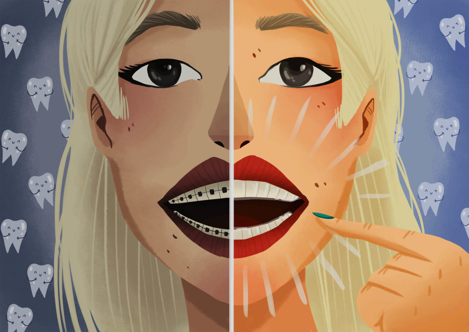 A blonde teenager comparing metal braces vs. Invisalign