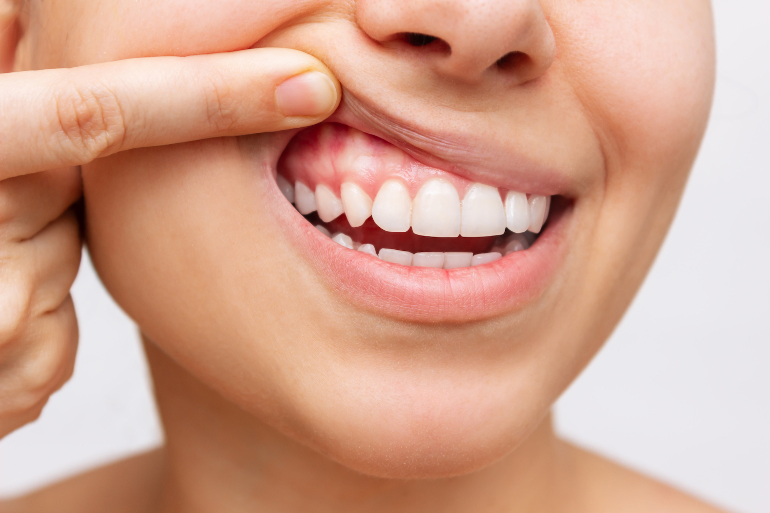 A woman pulls up her upper lip to show her healthy gums and her white teeth