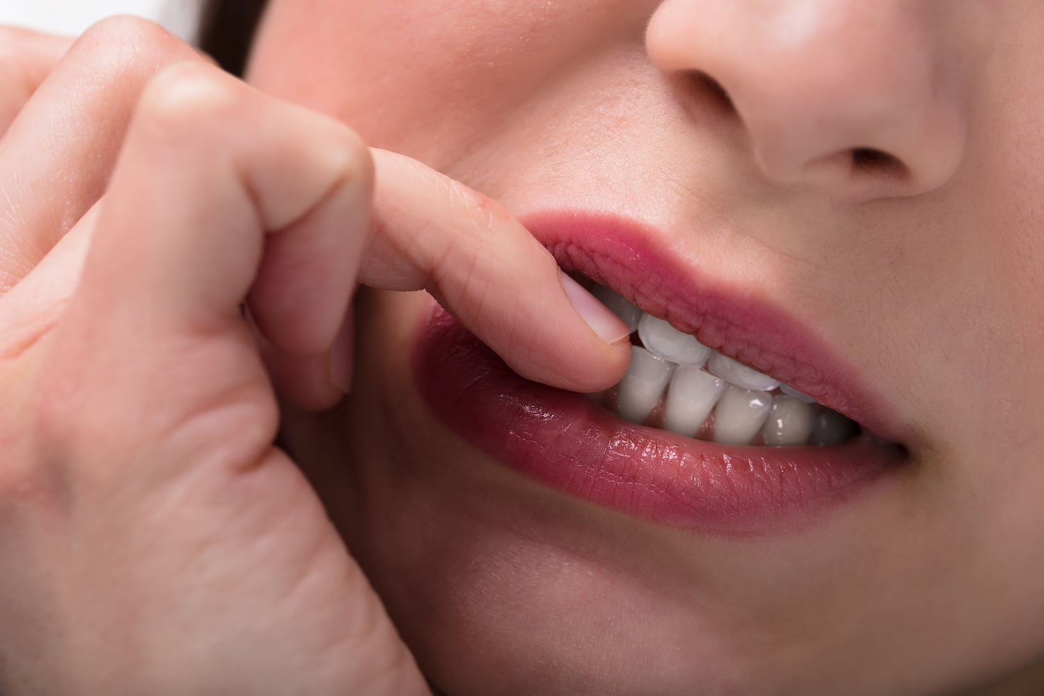Closeup of a woman biting her nails