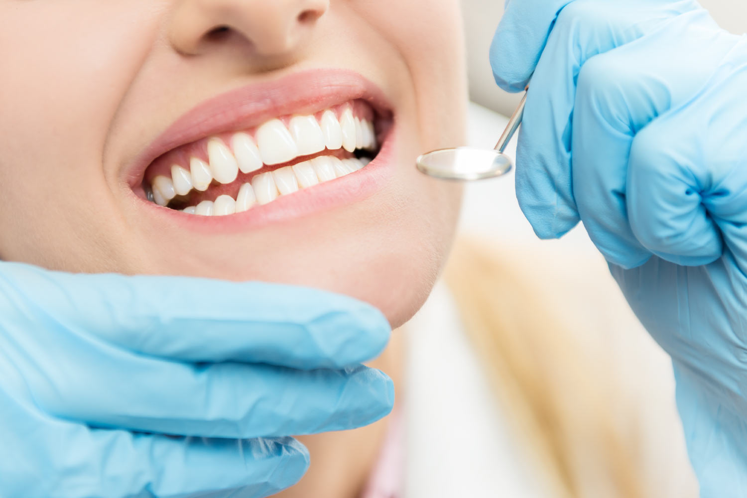 closeup of a woman's mouth after PerioProtect has treated her gum disease at CarolinasDentist