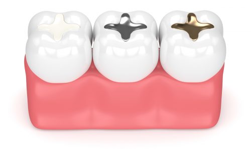 fillings-north-carolina filings